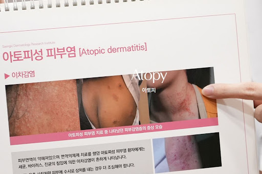 생기한의원으로 확인하는 아토피 초기 피부 건조 변화 특징